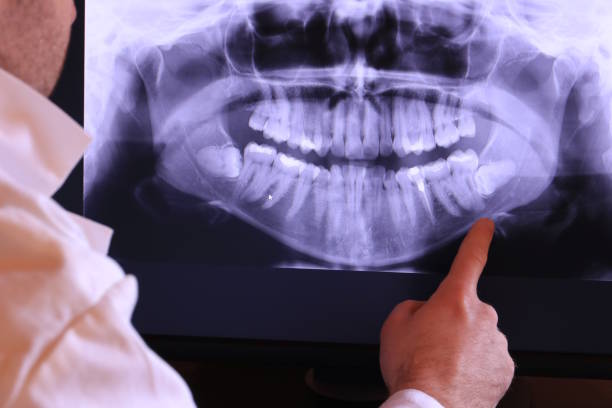 Best Emergency Wisdom Teeth Removal in Jal, NM