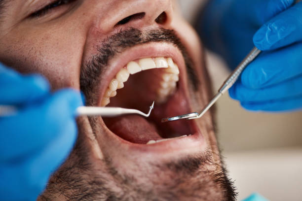 Best Emergency Dental Care for Broken or Chipped Teeth in Jal, NM